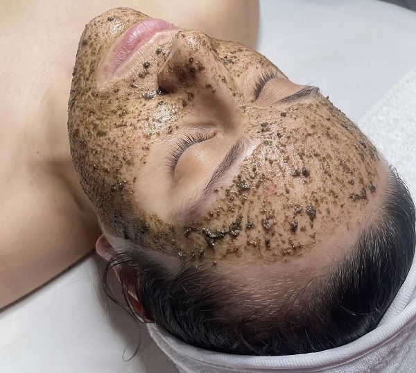 Painless biomicroneedling treatment