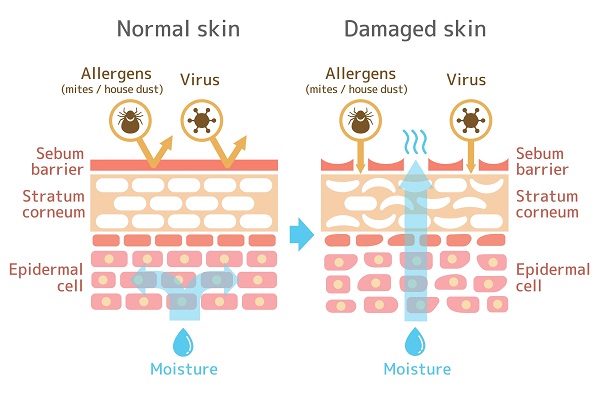 Healthy vs damaged skin barrier